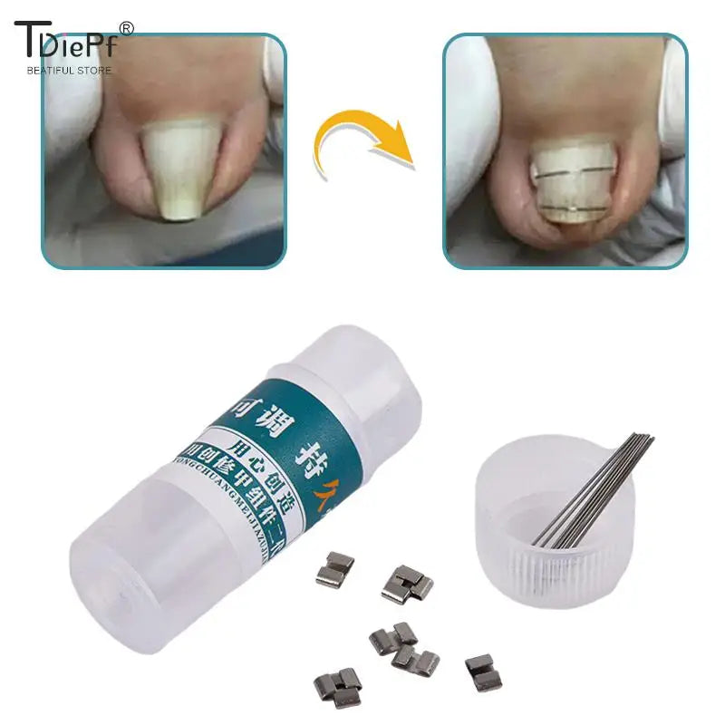 Ingrown Toenail Corrector Tools Pedicure — Swuffy