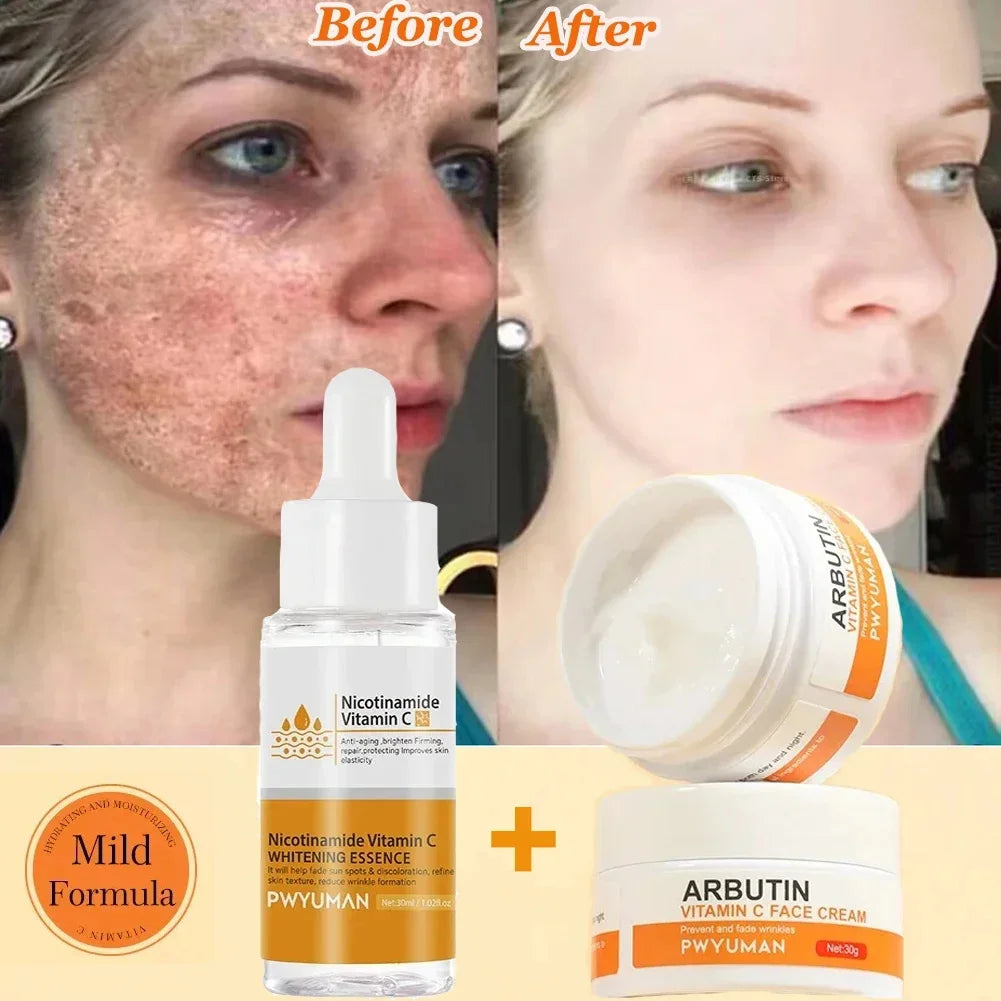 Dark Spots Remover Whitening Face — Swuffy
