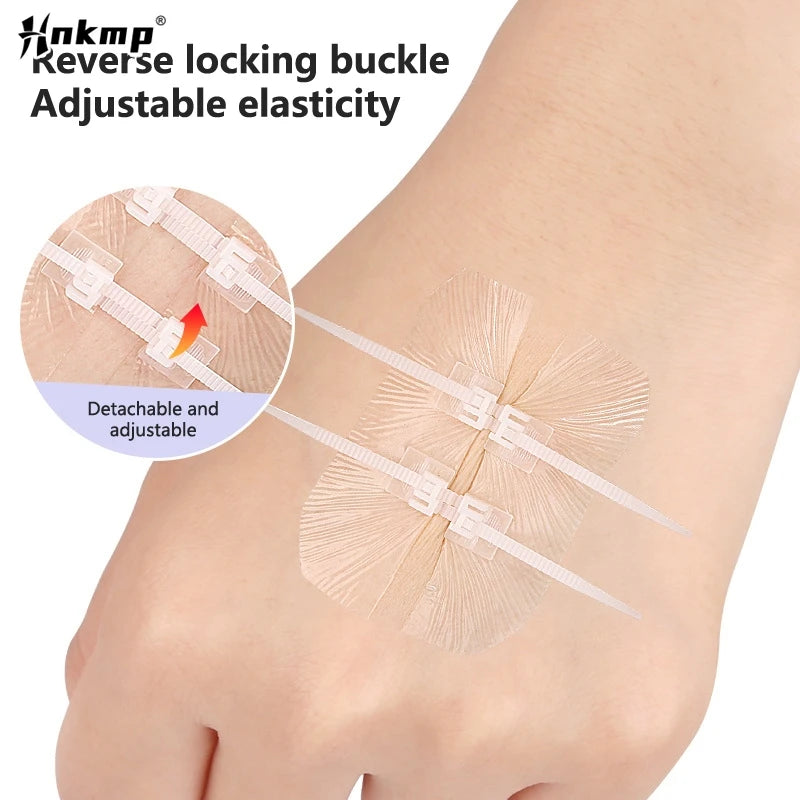 Zip Stitch Wound Bandages Emergency — Swuffy