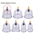 Vacuum Cupping Glasses Vacuum Massage — Swuffy