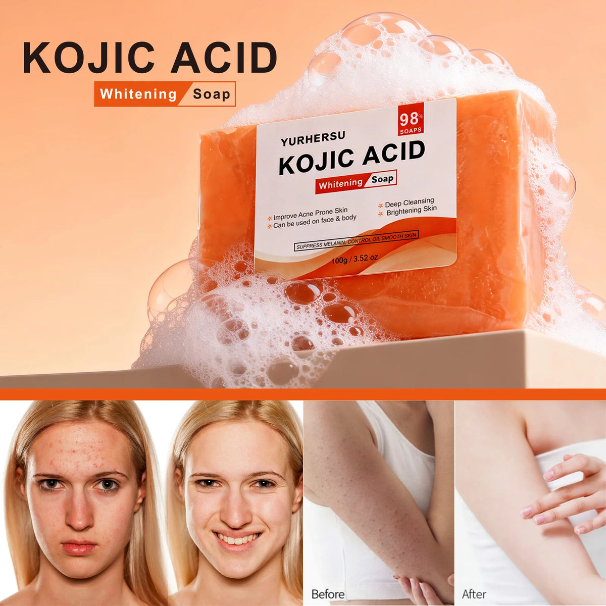 Kojic Acid Soap Facial Cleanser — Swuffy