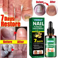 Days Nail Fungus Treatment Serum — Swuffy