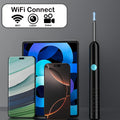 WiFi Visual Ear Wax Remover — Swuffy