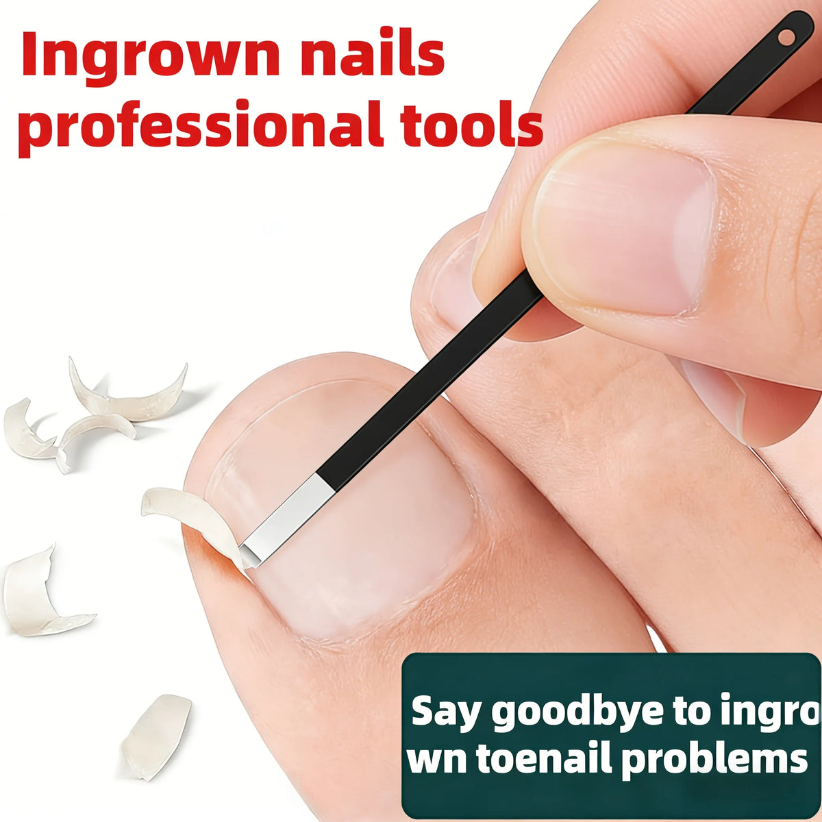 Stainless Steel Ingrown Toenail Correction — Swuffy
